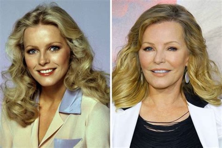 Cheryl Ladd Plastic Surgery – Botox And Lip Fillers, Before And After Photos Explored